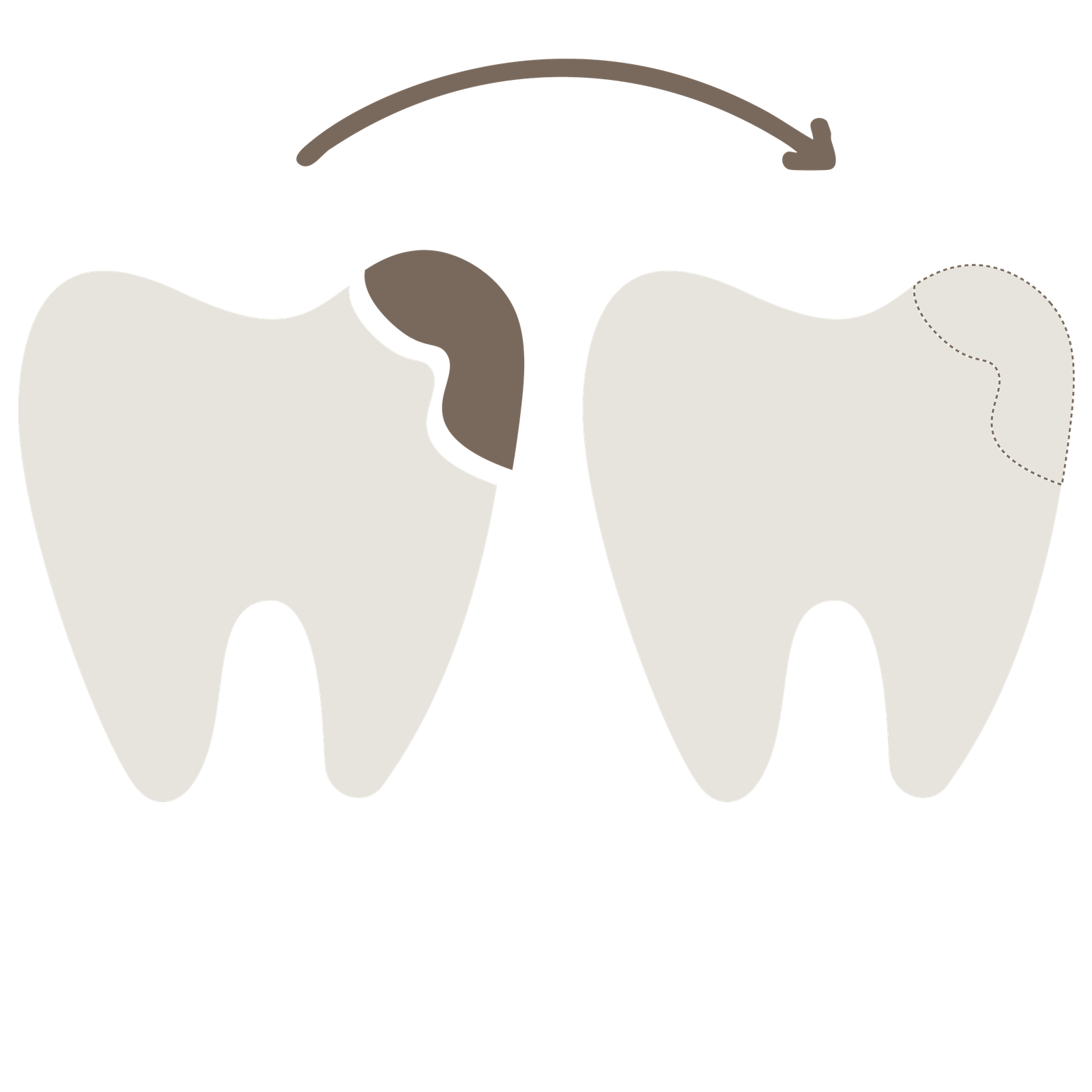 crowns